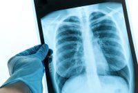 Understanding Radiology - Radiology - HealthClips Online Understanding Radiology - Radiology - HealthClips Online